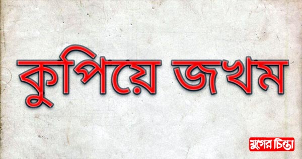 ফতুল্লায় ব্যবসায়ীকে কুপিয়ে জখম